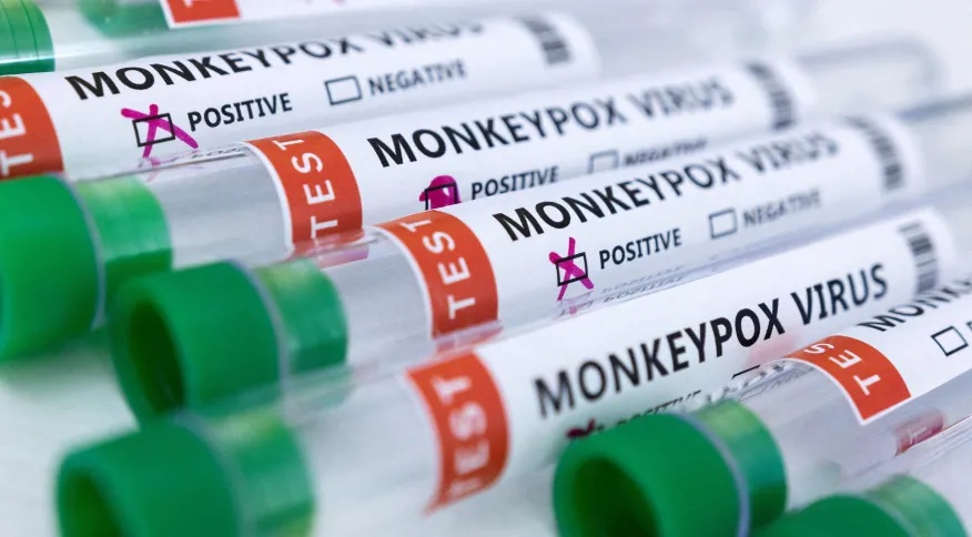 Saúde: prefeitura de Cuiabá confirma mais dois casos de Monkeypox