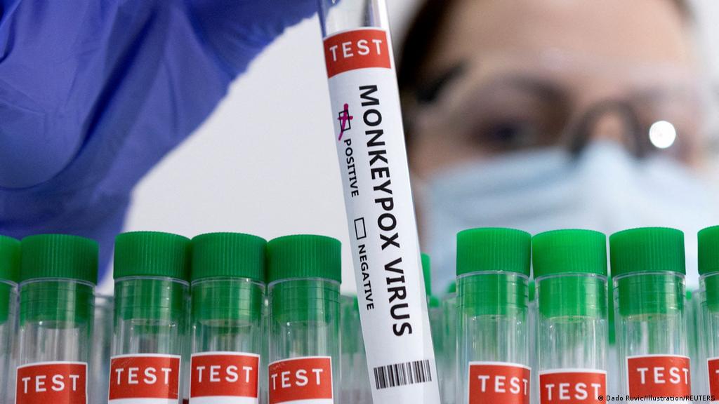 Estado registra quatro novos casos positivos para varíola dos macacos